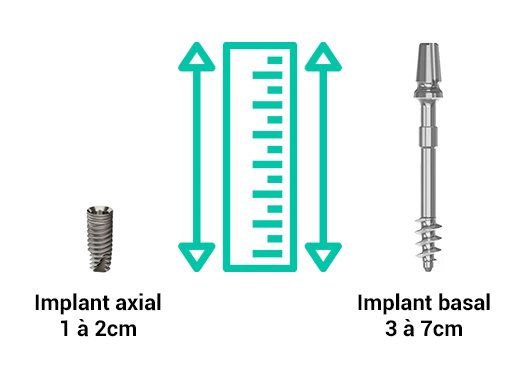 implant dentaire axial vs basal